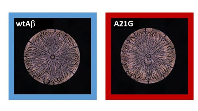 Alzheimer: Las redes neuronales pueden detectar diferencias mínimas en los patrones de tinción de las soluciones de péptidos secos