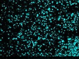 Cáncer: Nuevo método y dispositivo para aislar células individuales usando campos eléctricos Para que los investigadores del cáncer analicen y secuencien células individuales de tejidos complejos como los tumores, esas células primero deben disociarse de las muestras a granel