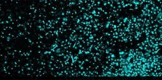 Cáncer: Nuevo método y dispositivo para aislar células individuales usando campos eléctricos Para que los investigadores del cáncer analicen y secuencien células individuales de tejidos complejos como los tumores, esas células primero deben disociarse de las muestras a granel