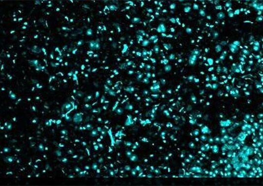 Cáncer: Nuevo método y dispositivo para aislar células individuales usando campos eléctricos Para que los investigadores del cáncer analicen y secuencien células individuales de tejidos complejos como los tumores, esas células primero deben disociarse de las muestras a granel