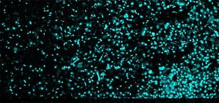 Para que los investigadores del cáncer analicen y secuencien células individuales de tejidos complejos como los tumores, esas células primero deben disociarse de las muestras a granel Para que los investigadores del cáncer analicen y secuencien células individuales de tejidos complejos como los tumores, esas células primero deben disociarse de las muestras a granel