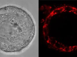 Los óvulos humanos se mantienen saludables durante décadas al poner las ‘baterías en modo de espera’ Óvulos: Imágenes de células vivas del folículo humano, que muestran células de la granulosa en la capa externa, que sostienen el ovocito, contenido en su interior