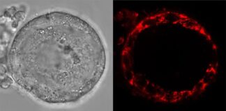 Los óvulos humanos se mantienen saludables durante décadas al poner las ‘baterías en modo de espera’ Óvulos: Imágenes de células vivas del folículo humano, que muestran células de la granulosa en la capa externa, que sostienen el ovocito, contenido en su interior