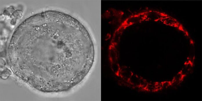 Óvulos: Imágenes de células vivas del folículo humano, que muestran células de la granulosa en la capa externa, que sostienen el ovocito, contenido en su interior Óvulos: Imágenes de células vivas del folículo humano, que muestran células de la granulosa en la capa externa, que sostienen el ovocito, contenido en su interior
