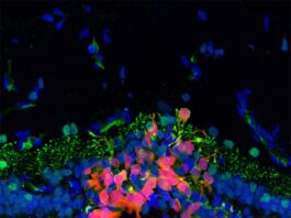Progreso hacia una terapia basada en células madre para la ceguera Tratamiento de la ceguera: Después de un procedimiento de trasplante, las células precursoras de fotorreceptores humanos marcadas en rojo migraron y se integraron en una retina canina degenerada