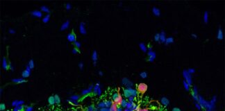 Progreso hacia una terapia basada en células madre para la ceguera Tratamiento de la ceguera: Después de un procedimiento de trasplante, las células precursoras de fotorreceptores humanos marcadas en rojo migraron y se integraron en una retina canina degenerada