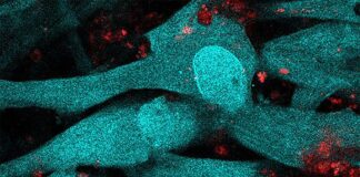 El cerebro puede detectar la infección por malaria: En busca de un menor daño neurológico Las células endoteliales vasculares del cerebro (azul) internalizan partículas liberadas por los eritrocitos infectados con el parásito de la malaria (rosa y rojo)