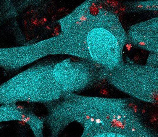 El cerebro puede detectar la infección por malaria: En busca de un menor daño neurológico Las células endoteliales vasculares del cerebro (azul) internalizan partículas liberadas por los eritrocitos infectados con el parásito de la malaria (rosa y rojo)