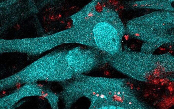 Las células endoteliales vasculares del cerebro (azul) internalizan partículas liberadas por los eritrocitos infectados con el parásito de la malaria (rosa y rojo)
