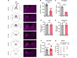 Vínculo entre la apnea del sueño y la demencia, según un estudio en ratones La urotensina II-saporina induce lesiones específicas de las neuronas colinérgicas en el tegmento mesopontino debido a la apnea del sueño