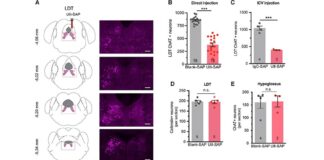 Vínculo entre la apnea del sueño y la demencia, según un estudio en ratones La urotensina II-saporina induce lesiones específicas de las neuronas colinérgicas en el tegmento mesopontino debido a la apnea del sueño