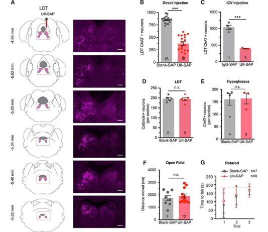 Vínculo entre la apnea del sueño y la demencia, según un estudio en ratones La urotensina II-saporina induce lesiones específicas de las neuronas colinérgicas en el tegmento mesopontino debido a la apnea del sueño