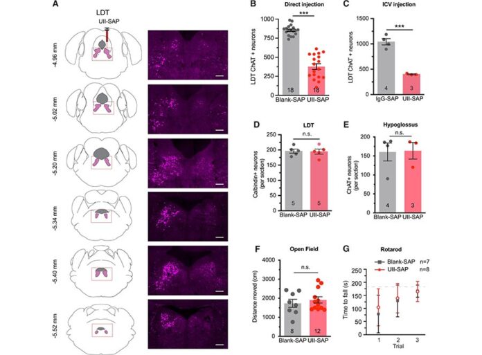 La urotensina II-saporina induce lesiones específicas de las neuronas colinérgicas en el tegmento mesopontino debido a la apnea del sueño