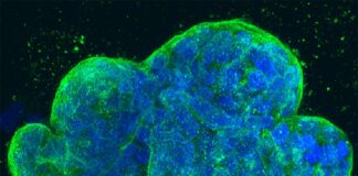 Vacuna contra el cáncer de mama genera inmunidad antitumoral de forma segura en un estudio preliminar Cultivo tridimensional de células de cáncer de mama humano