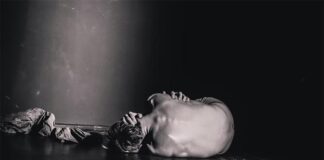 Esclerosis múltiple: Trasplante de células madre sanguíneas para reiniciar el sistema inmunitario Dolor