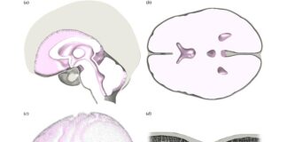El cerebro humano es igual de blando que la gelatina y se rompe más fácilmente que el poliestireno Geometría del modelo final del cerebro