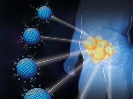 Nanomateriales cargados positivamente tratan la obesidad en cualquier lugar del cuerpo Obesidad: Ilustración de la focalización específica del depósito de grasa por nanomateriales catiónicos