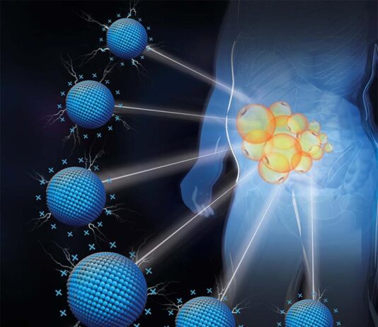 Nanomateriales cargados positivamente tratan la obesidad en cualquier lugar del cuerpo Obesidad: Ilustración de la focalización específica del depósito de grasa por nanomateriales catiónicos