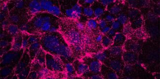 Células tolerantes al estrés impulsan la iniciación del cáncer de páncreas Cáncer de páncreas: Las células iniciadoras de tumores (azul) producen una matriz extracelular que contiene fibronectina (rosa), lo que les confiere una mayor tolerancia al estrés, resistencia a los medicamentos y propiedades iniciadoras de tumores