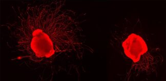 Polineuropatía desmielinizante: El propionato protege las células nerviosas y las ayuda a regenerarse Polineuropatía desmielinizante inflamatoria crónica: Crecimiento de células nerviosas con y sin la administración de propionato