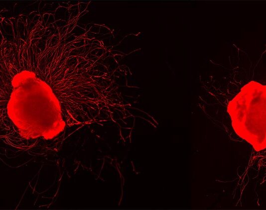 Polineuropatía desmielinizante: El propionato protege las células nerviosas y las ayuda a regenerarse Polineuropatía desmielinizante inflamatoria crónica: Crecimiento de células nerviosas con y sin la administración de propionato