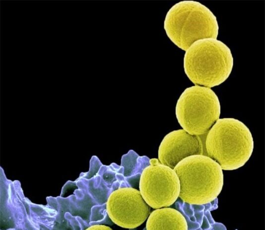 Probiótico reduce notablemente la colonización por Staphylococcus aureus en un ensayo de fase 2 Bacteria Staphylococcus aureus resistente a la meticilina (amarilla) siendo ingerida por neutrófilos