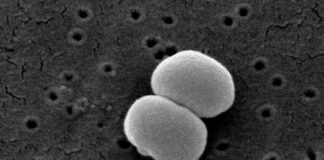 Usan bacterias colonizadoras de la piel para crear una terapia tópica contra el cáncer en ratones Cáncer: Los investigadores diseñaron Staphylococcus epidermidis, una bacteria, para producir una proteína que estimula el sistema inmunológico