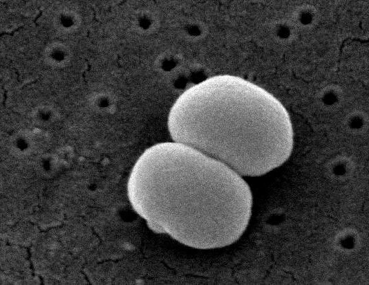 Usan bacterias colonizadoras de la piel para crear una terapia tópica contra el cáncer en ratones Cáncer: Los investigadores diseñaron Staphylococcus epidermidis, una bacteria, para producir una proteína que estimula el sistema inmunológico