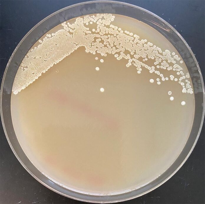 Bacterias y producción industrial